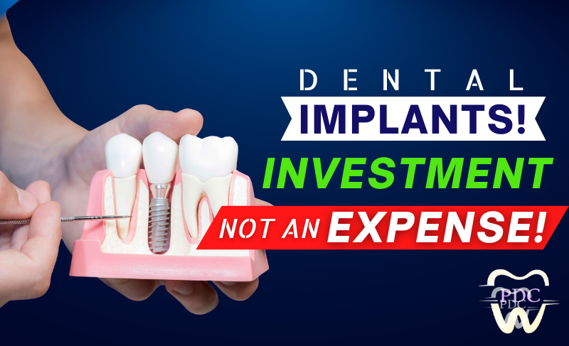 Dental Implants-An investment Not An Expense!