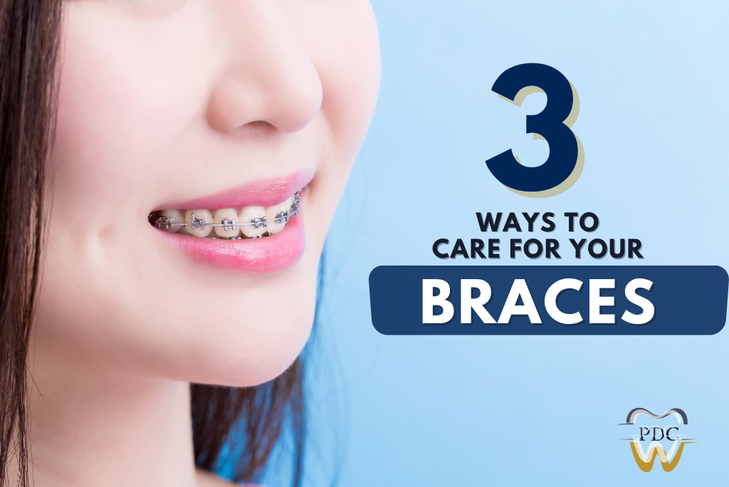 3 Ways To Care For Your Braces