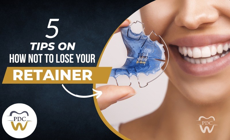 5 Tips on How Not To Lose Your Retainer or Aligner