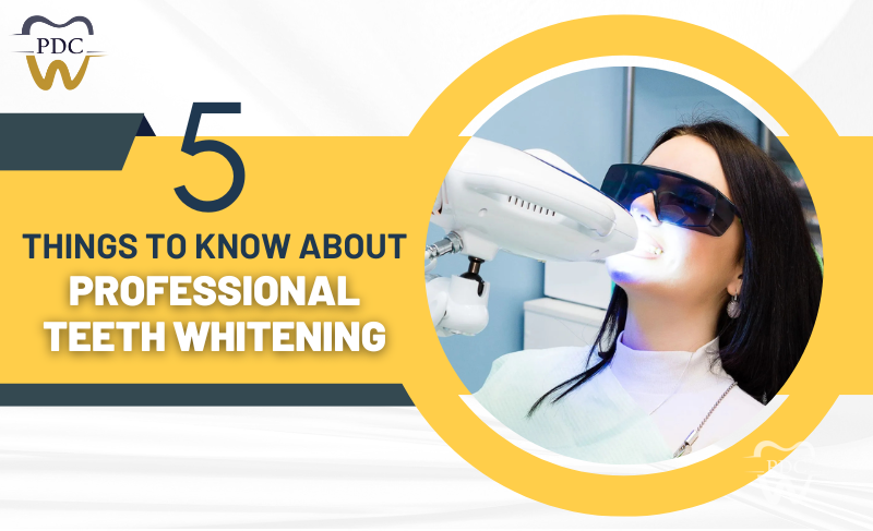 5 Things To Know About Professional Teeth Whitening