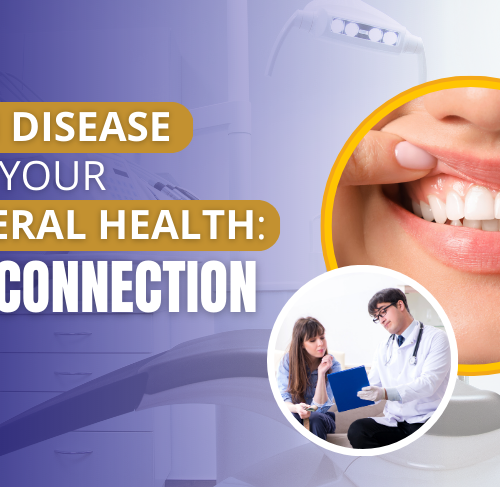Gum Treatment in HSR Layout