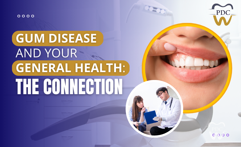 Gum Treatment in HSR Layout