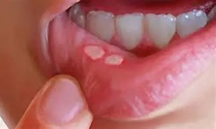 Tooth care illustration image