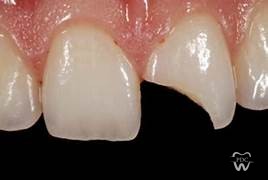 Emergency dental care