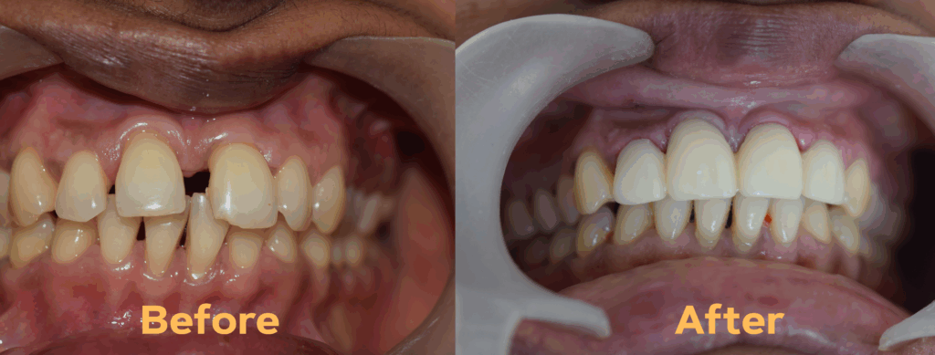 cosmetic dental treatments