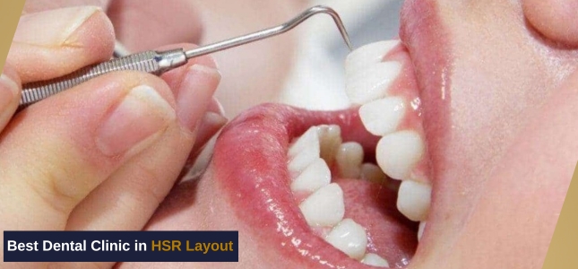 Best Dental Clinic in HSR Layout | Complete Dental Care for Long-Term Oral Health